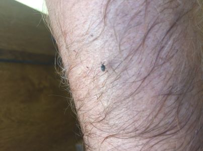 A - nejednoznačne určen&yacute;, nie sme si ist&iacute;