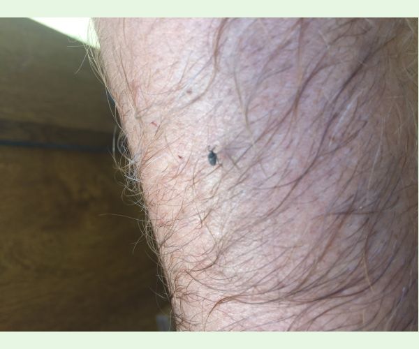 A - nejednoznačne určený, nie sme si istí