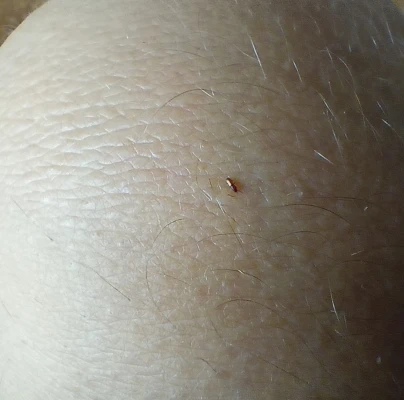 A - nejednoznačne určen&yacute;, nie sme si ist&iacute;